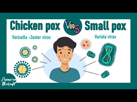 Chicken Pox vs Small Pox | Variola vs varicella virus