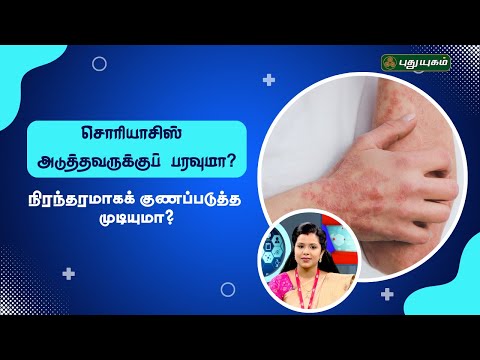 சொரியாசிஸ் பாதிப்பை நிரந்தரமாகக் குணப்படுத்த முடியுமா? Dr. Bhuvaneswari #Doctoroncall #puthuyugamtv