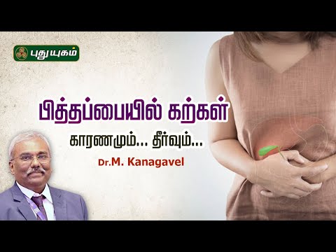 பித்தப்பையில் கற்கள் காரணமும்... தீர்வும்... Dr. M.Kanagavel #kelvigalayiram #puthuyugamtv