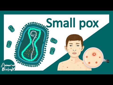 Small Pox | Variola virus | Small pox vs chicken pox | Virology